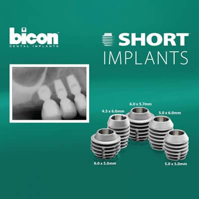 bicon-implants-koos-chcago